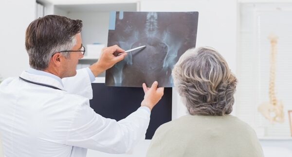 Osteoporosis - Médico especialista en salud ósea evaluando la radiografía de una mujer para determinar la pérdida de masa ósea en uno de los mejores centros de osteoporosis de Barcelona